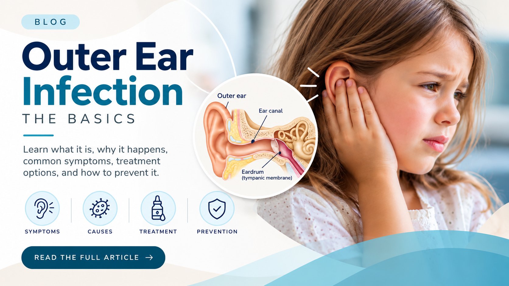 Oreille du nageur (otite externe) : comment la reconnaître, la traiter et la prévenir